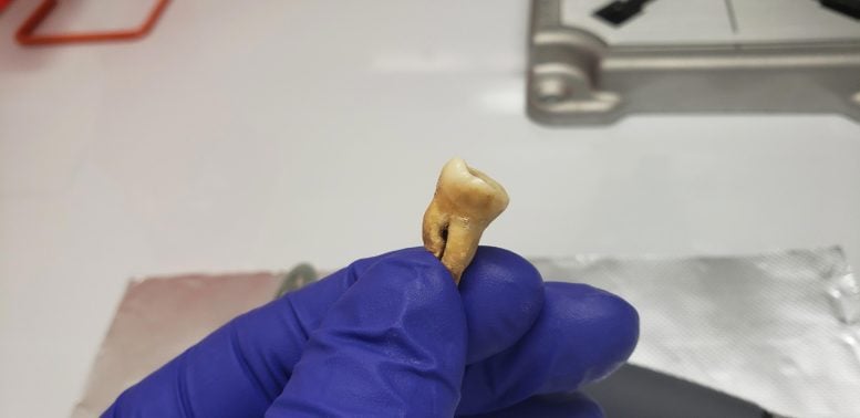 USF Researcher Holding Excavated Human Tooth With Roots