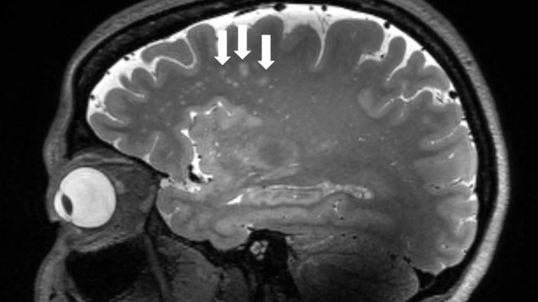 How Touching Is Perceived In The Brain Investigated With Two Person Mri Scans On Couples 7085