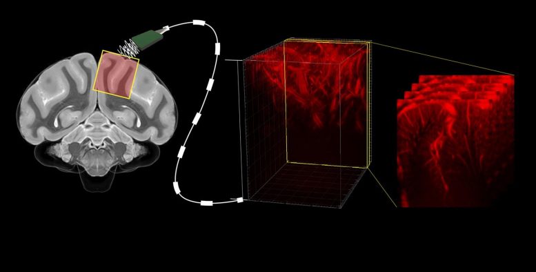 Ultrasound Brain Machine Interface