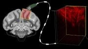 Ultrasound Brain-Machine Interface