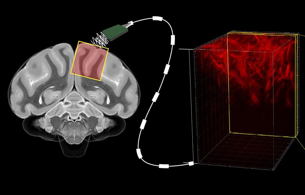 Caltech Scientists Can Predict Intelligence from Brain Scans
