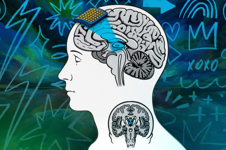 Ultrasound Brain Stimulation Illustration