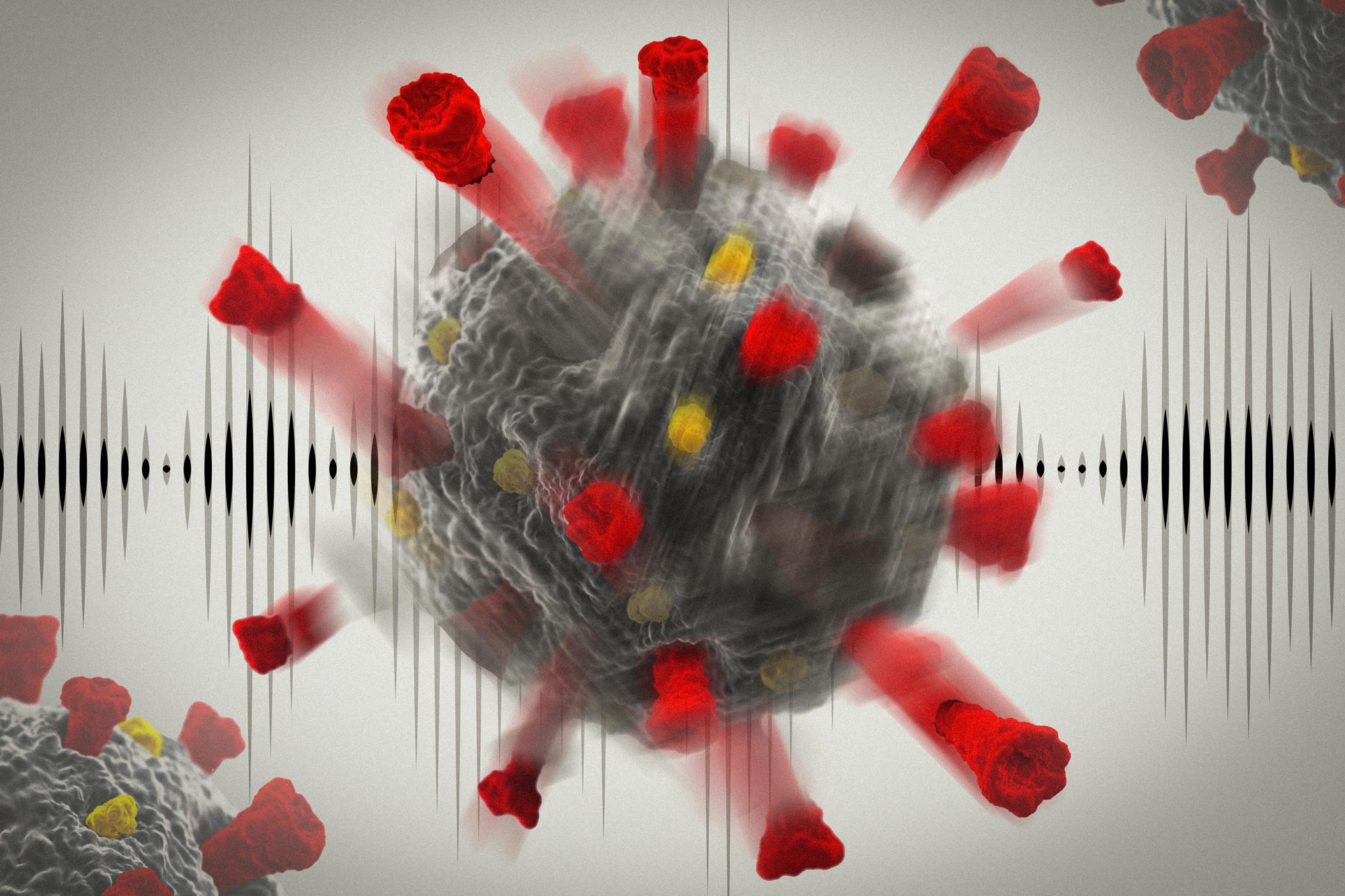 MIT says ultrasound can damage coronaviruses