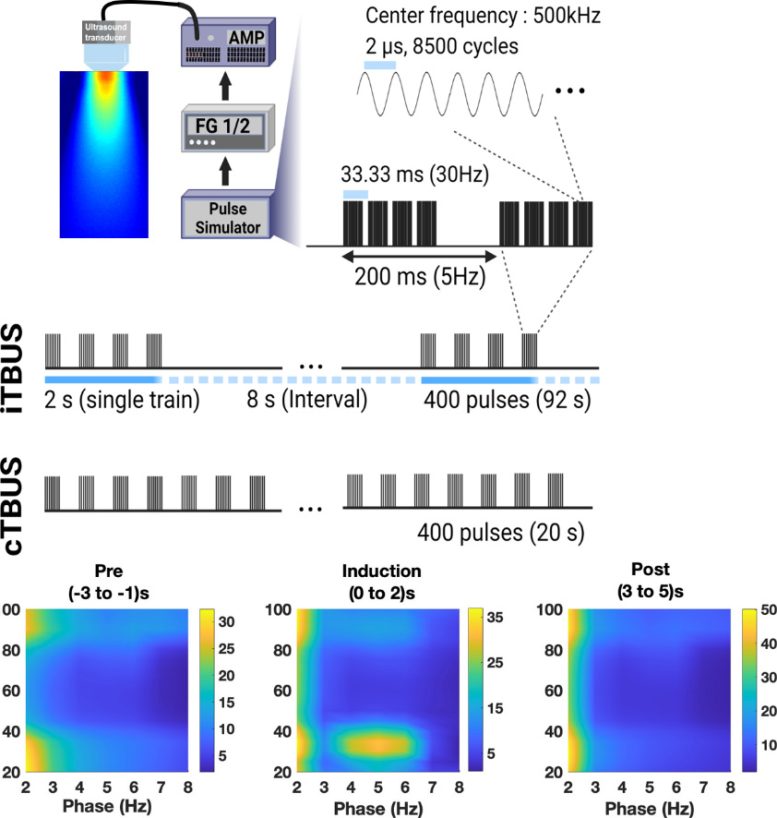 Ultrasound Experimental Parameters and Synchronization of Brain Waves