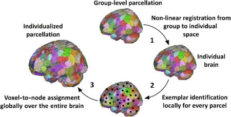 Understanding Ourselves Through Neuroimaging and Algorithms