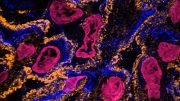 Unprecedented Views of Cell Interiors