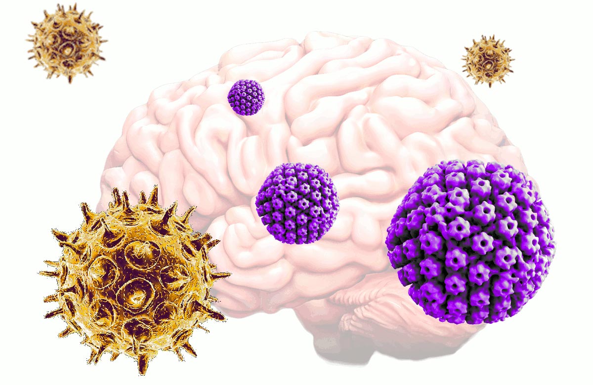 Virus Umum Dapat Menyebabkan Penyakit Alzheimer