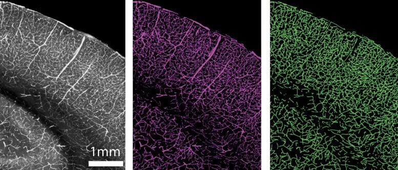 Células vasculares y estructuras como vasos sanguíneos en cerebros de ratones