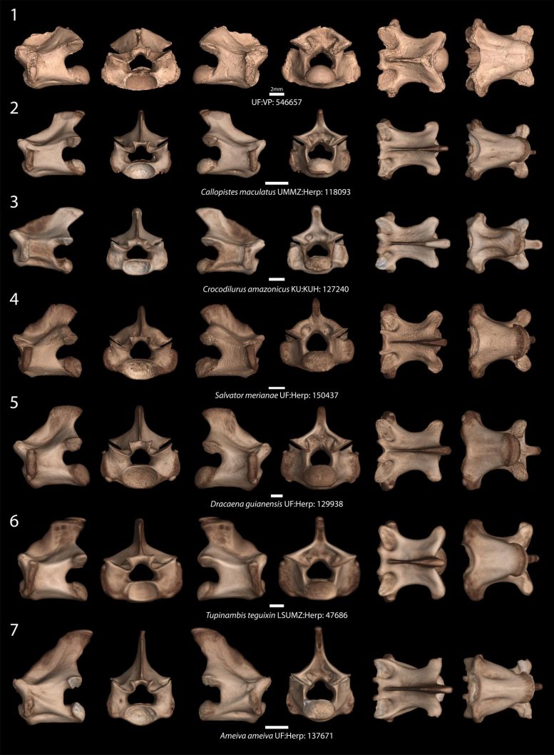 Vertebra Images Machine Learning