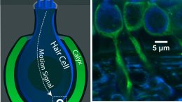 Vestibular Hair Cell Calyx Illustration and Microscopic Image