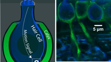 Vestibular Hair Cell Calyx Illustration and Microscopic Image