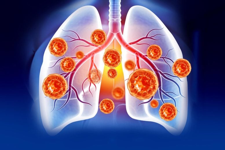 Scientists Just Overturned a 100-Year-Old Belief About Bacteria in the Lungs