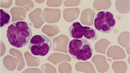 Virus Induced Leukaemia Cells