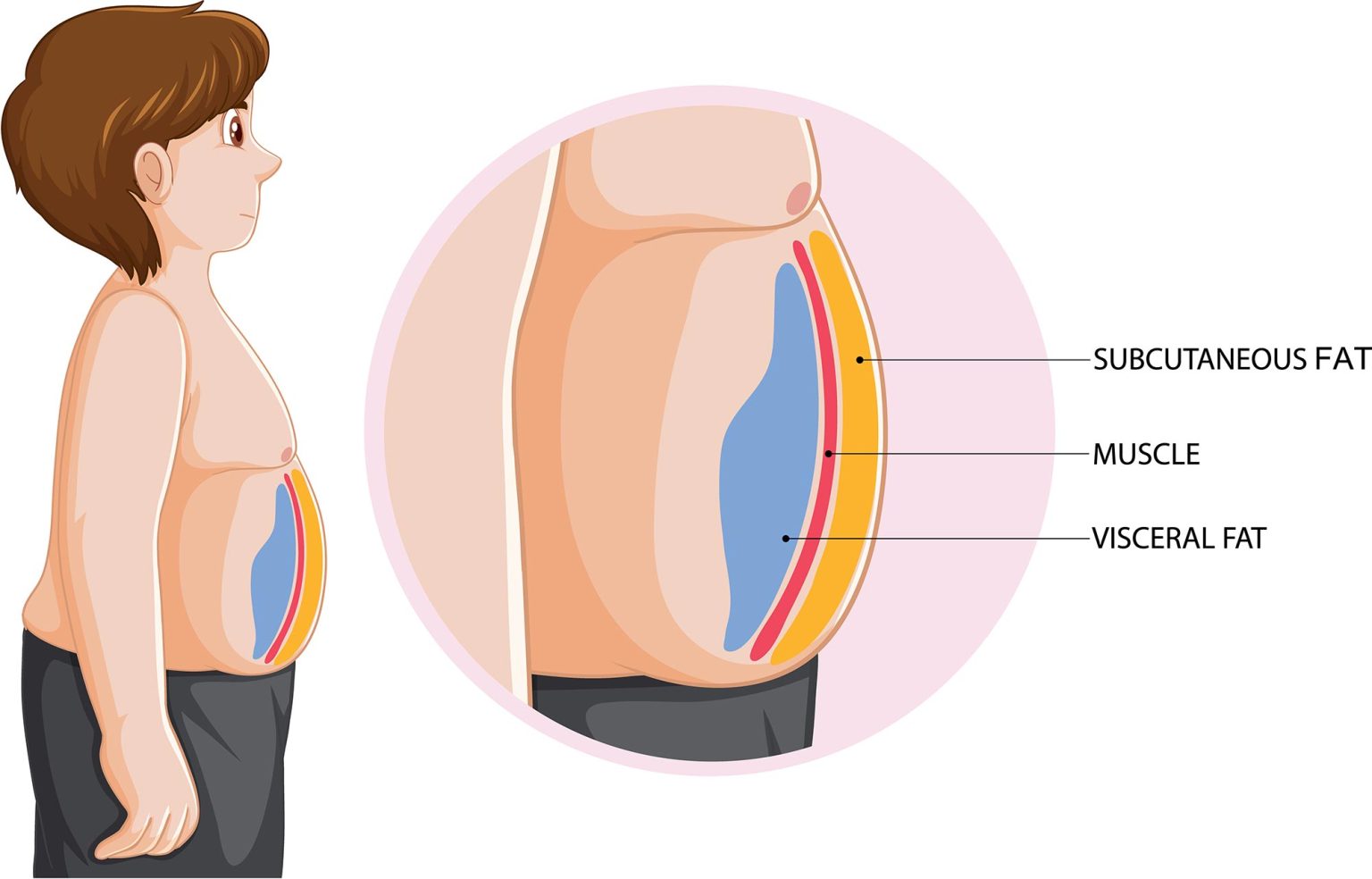 The “Apple” Crisis: The Hidden Dangers of Visceral Body Fat – And How ...
