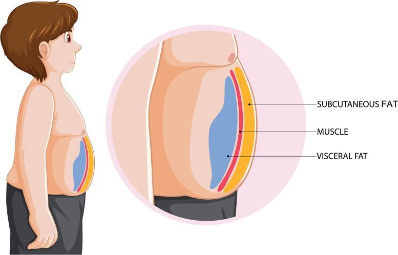 Visceral and Subcutaneous Fat