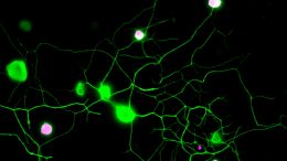 Visualizing Pain in Mouse Sensory Neurons