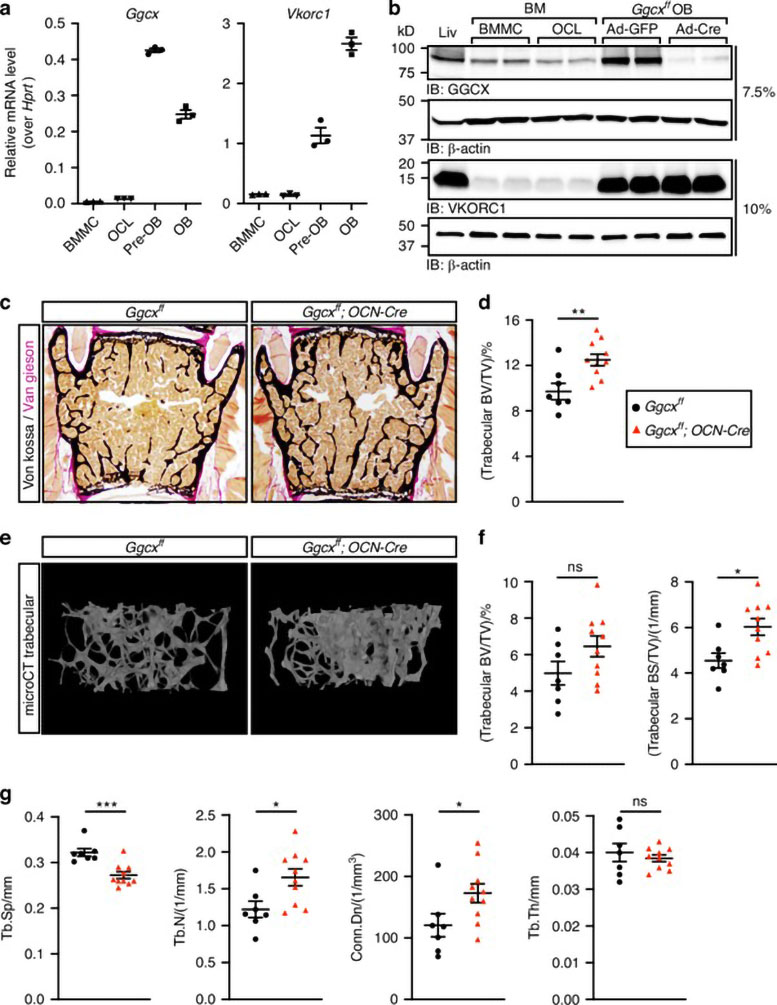 Vitamin K Dependent GAS6 Signaling Regulates Bone Resorption in Male Mice