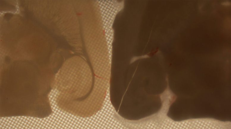 Vitrified and Crystallized Brain Tissue Sections