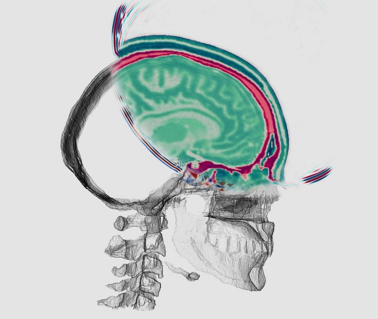 Waveform Brain Imaging