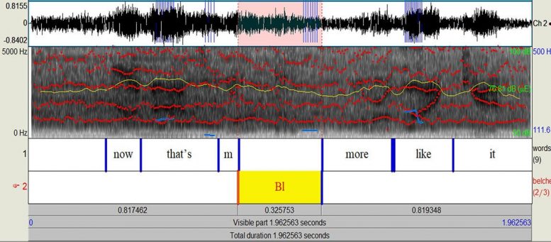 Waveform Spectrogram Belched Word