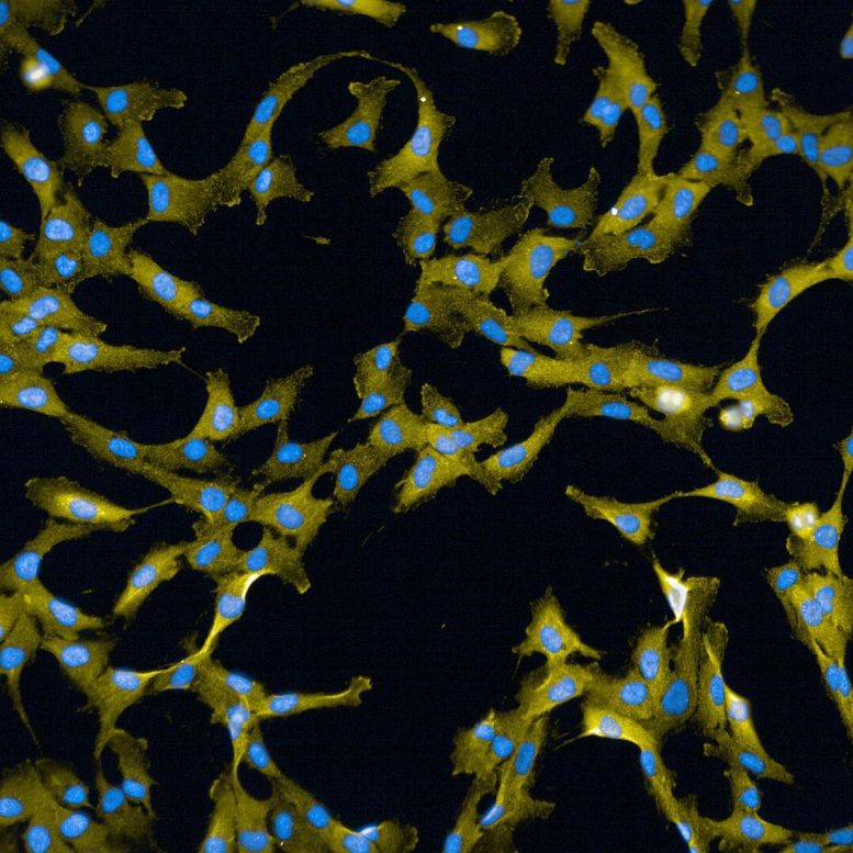 Wee1 Target in Human Epithelial Cells
