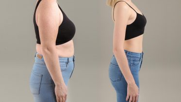 Weight Loss Concept Before and After