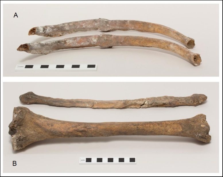 Westminster Abbey Skeleton Fractures and Infection Evidence