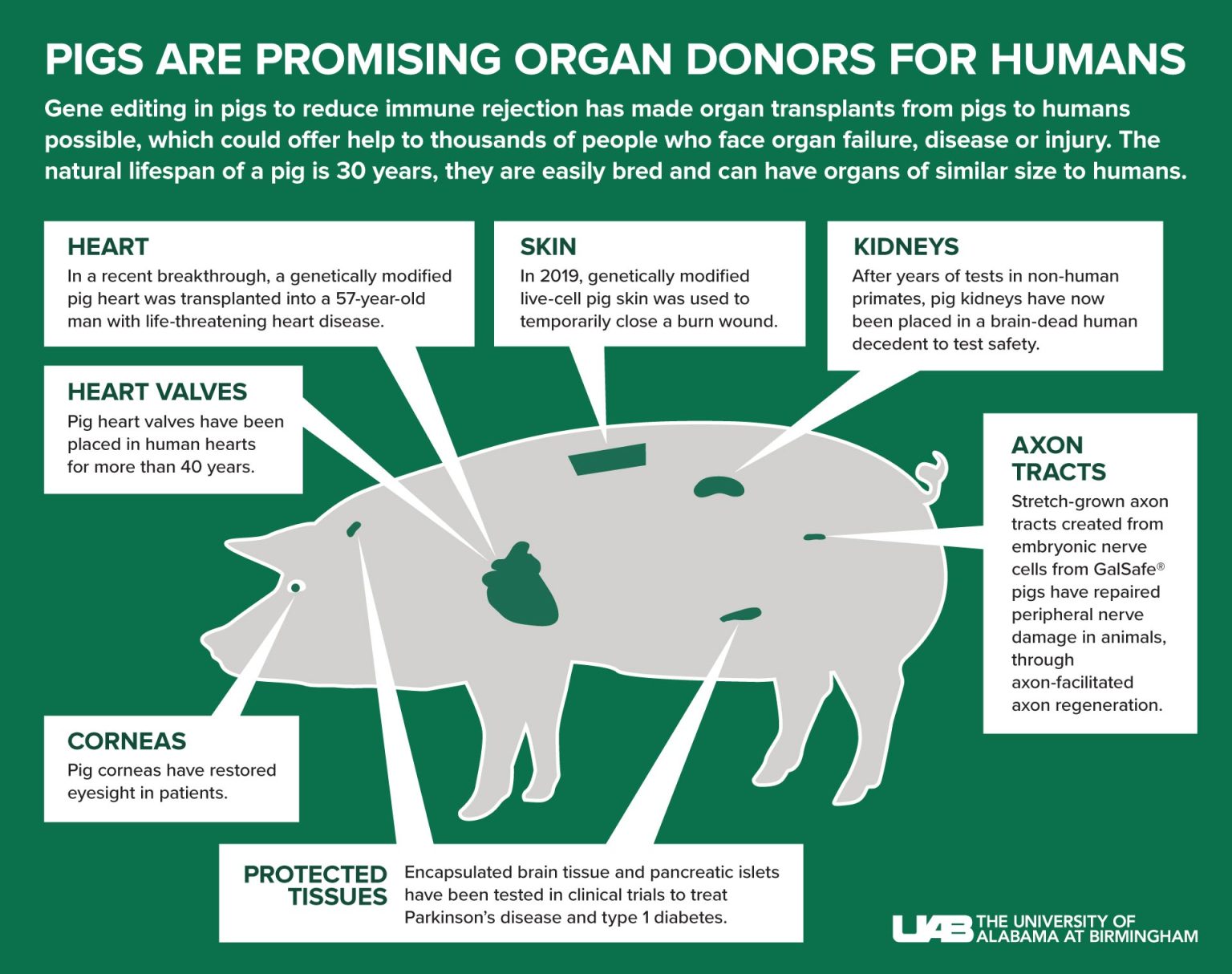 开创先河！首个临床级基因编辑猪肾移植给脑死亡的人 - 生物通