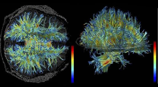 White Matter Changes Allow Older Brains to Learn