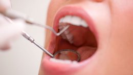 Woman Dental Exam