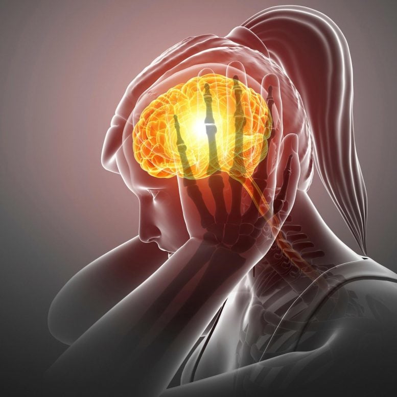 Woman Migraine Headache Brain Science Photo