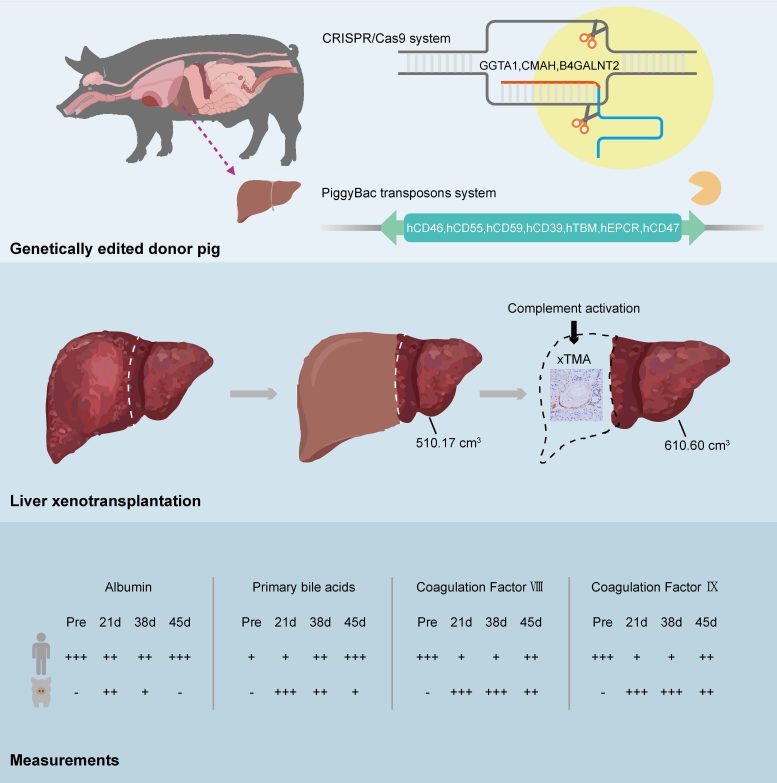 World&rsquo;s First Pig to Human Liver Xenotransplant Graphic
