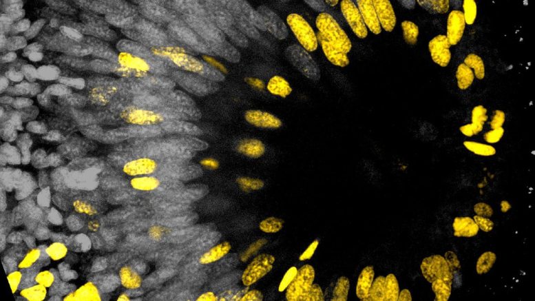 Worm&rsquo;s Eye With Dividing Cells
