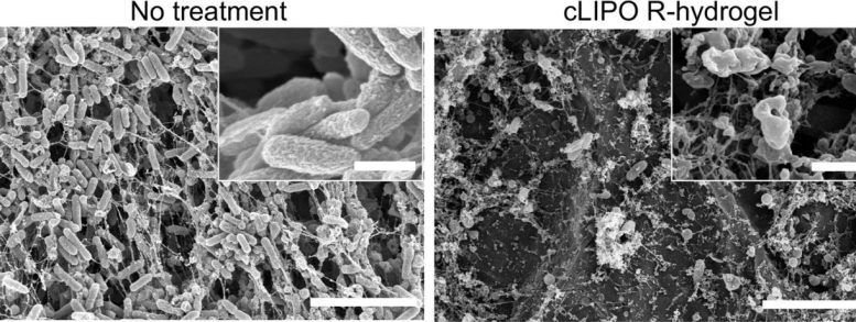 Wound With Bacteria vs Bacteria Free