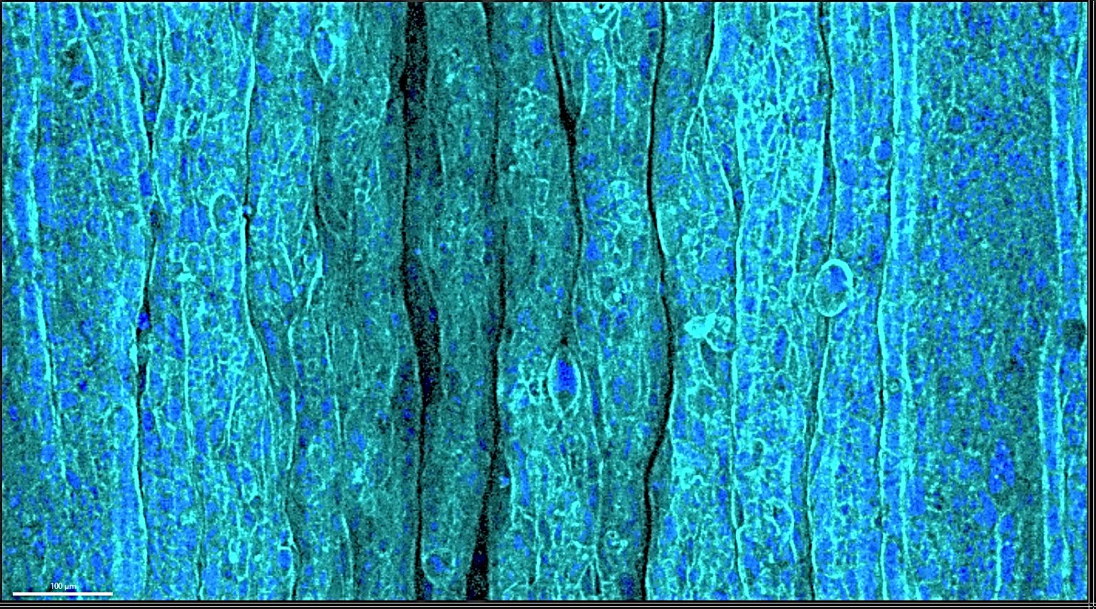 The Mystery of Human Wrinkles: Scientists Unveil Secret Mechanisms