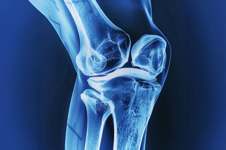 X-Ray Bones Knee Joint Wide