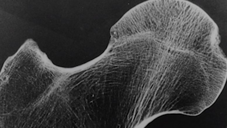 X-Ray Imaging Analyze Bone Structure