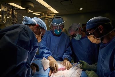 Xenotransplant Surgery