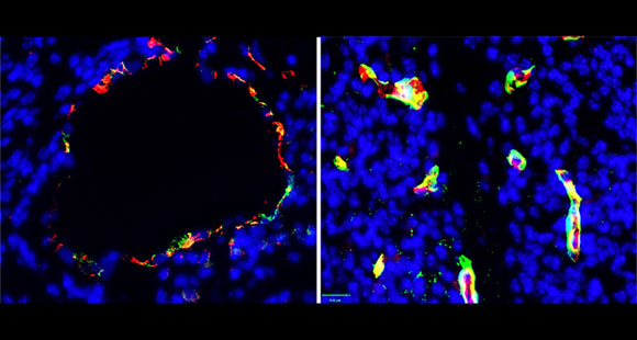 Yale Biologists Uncover Marker for a Chronic Brain Disease