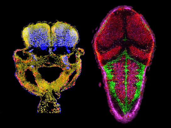 Yale Identifies Key Process in Brain Development
