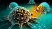 Yale Study Provides New Clue to How Cancer Cells Spread