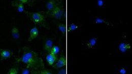 Yale Research Shows Cellular Clean-Up Can Also Sweep Away Forms of Cancer