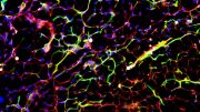 Yale Study Identifies a Therapeutic Target for Diabetes