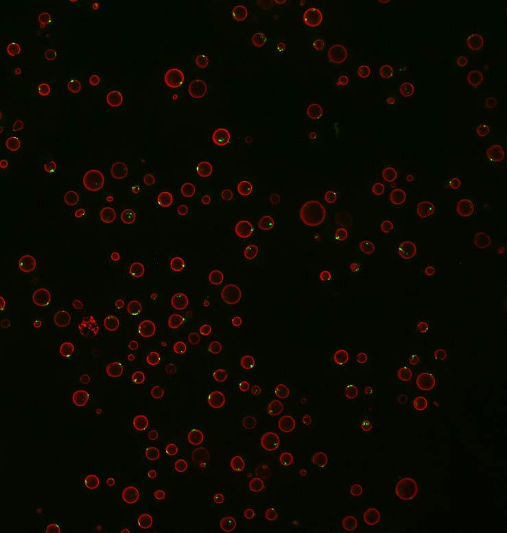Yeasts Under a Microscope