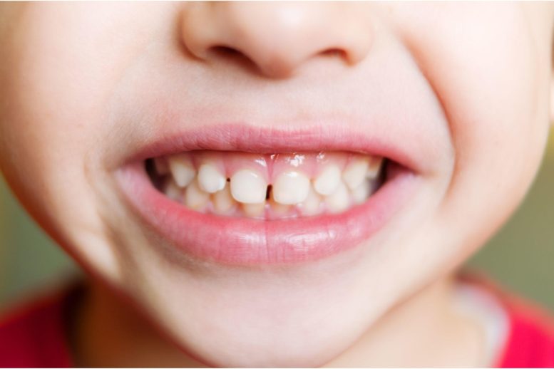 Young Child Teeth