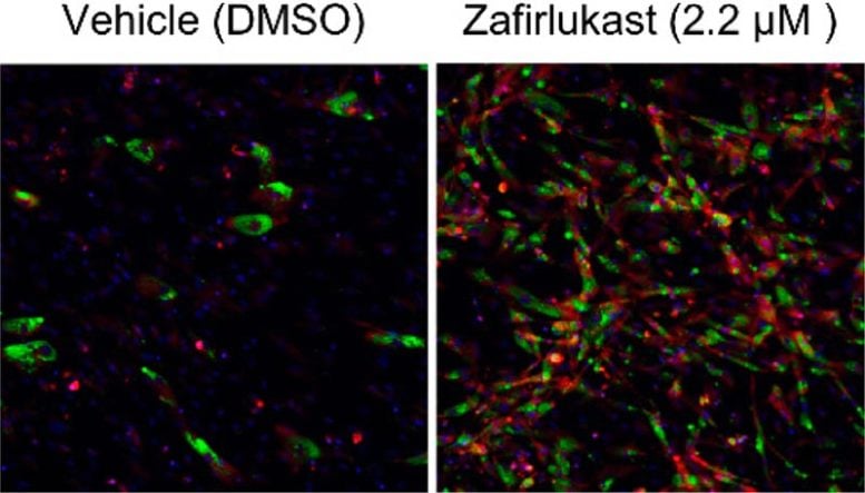 Zafirlukast Induces the Production of Brown Adipocyte Tissue