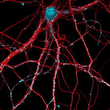 antibodies halt Alzheimer’s disease in mice