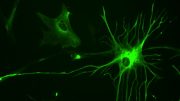 astrocyte cells help the brain respond to visual stimuli