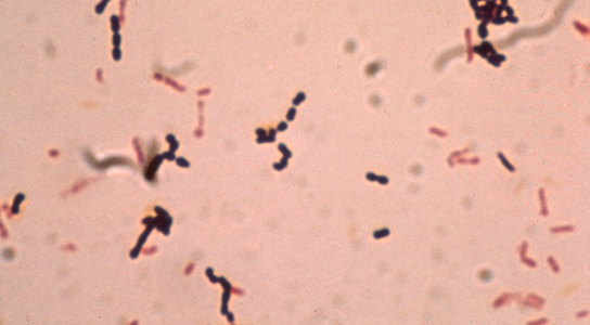 bacteroides-fragilis