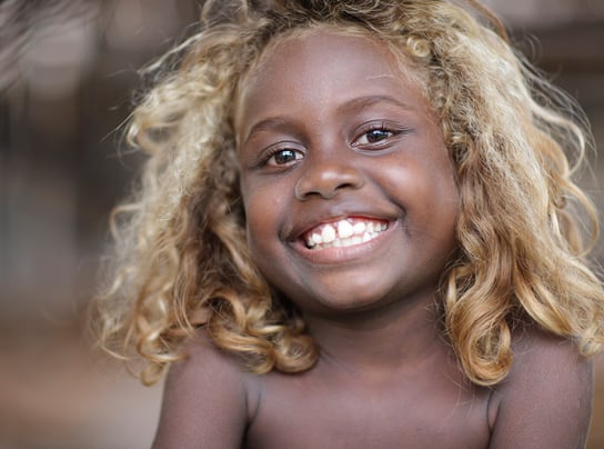 Blond Hair of Melanesians Evolved Differently Than Those of Europeans